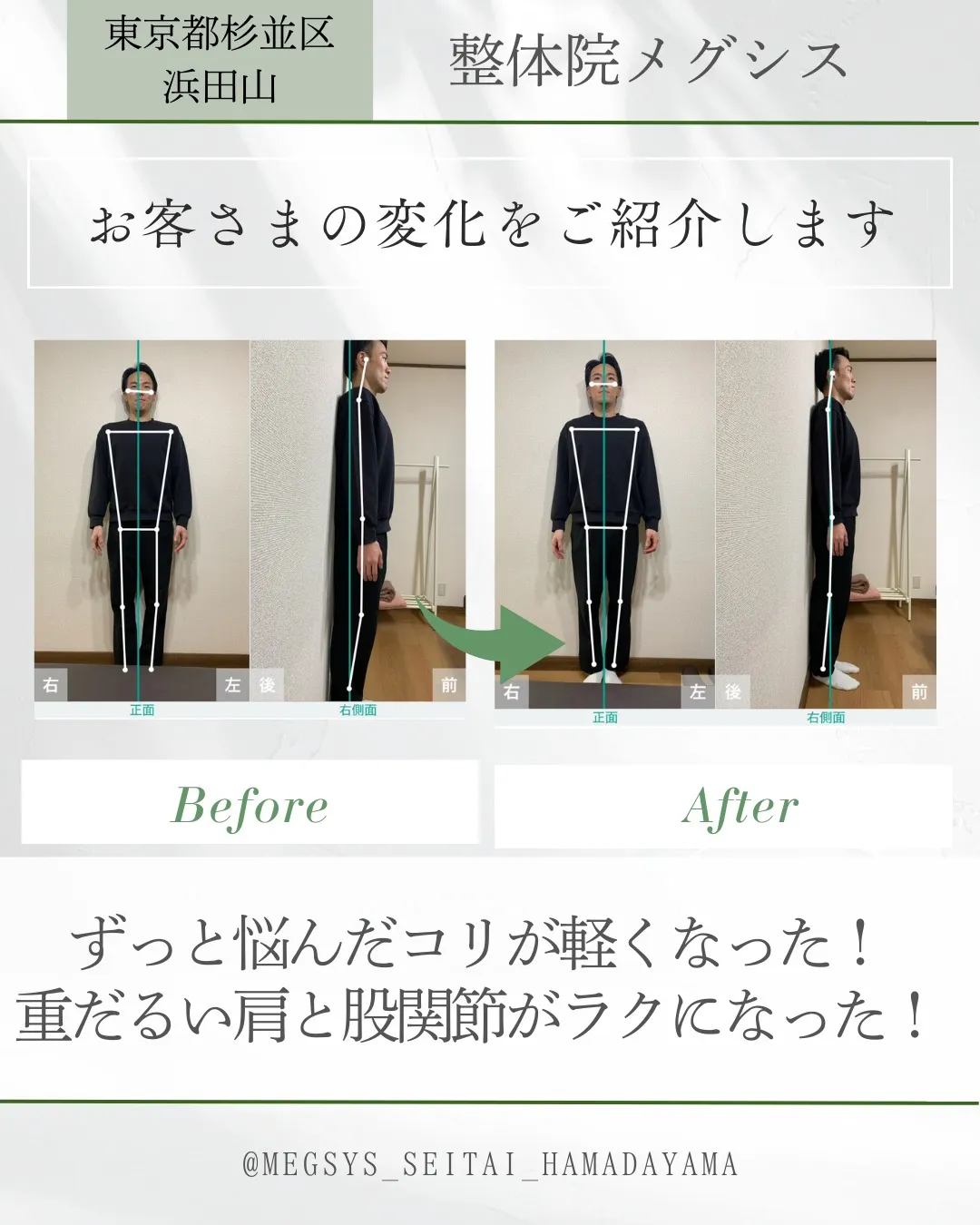 ずっと悩んだコリが軽くなった!