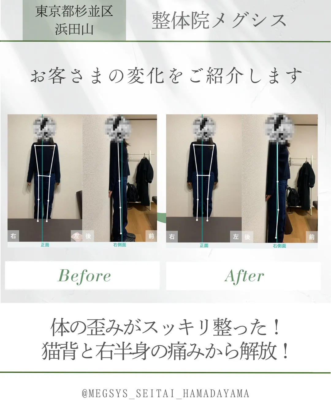 体の歪みがスッキリ整った！